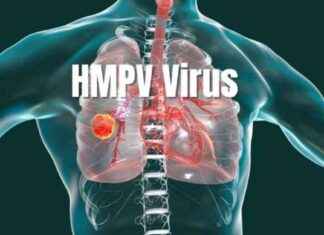 Steps to Handle HMPV Virus Exposure: Prevention and Treatment Guide steps-to-handle-hmpv-virus-exposure-prevention-and-treatment-guide