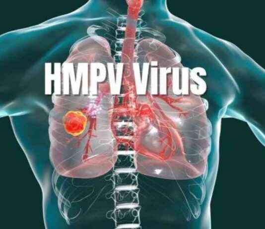 Steps to Handle HMPV Virus Exposure: Prevention and Treatment Guide steps-to-handle-hmpv-virus-exposure-prevention-and-treatment-guide