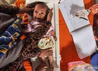 Factors contributing to childhood stunting: A comprehensive study factors-contributing-to-childhood-stunting-a-comprehensive-study